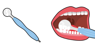 Spegel som undersöker tänderna i en mun